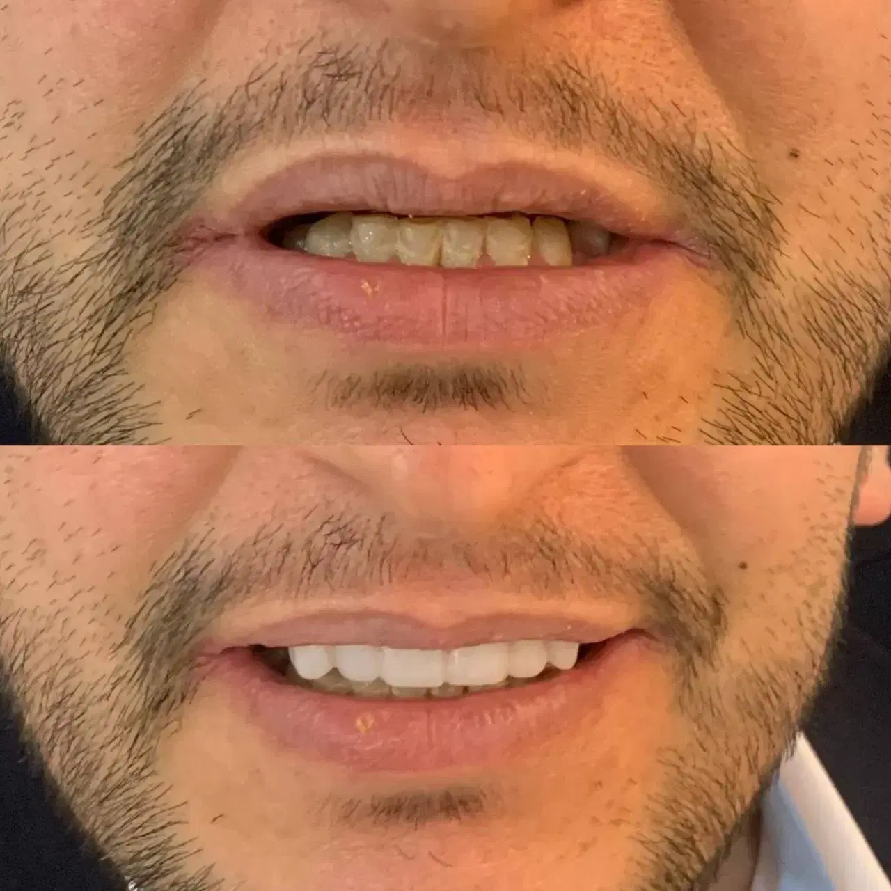 دندان مصنوعی تخصصی ژله ای،آلمانی|خدمات زیبایی و سلامت|کرج, گلشهر|دیوار