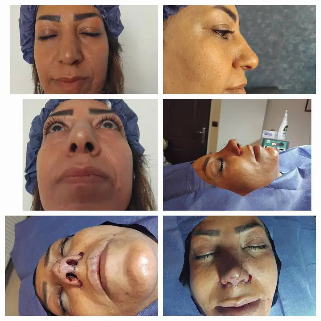 اد جراحی بینی|استخدام درمانی، زیبایی، بهداشتی|تهران, مرزداران|دیوار