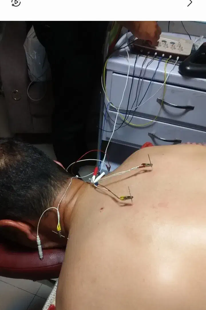 انجام فیزیوتراپی و طب سوزنی در کلینیک هفده شهریور|خدمات آرایشگری و زیبایی|تبریز, |دیوار