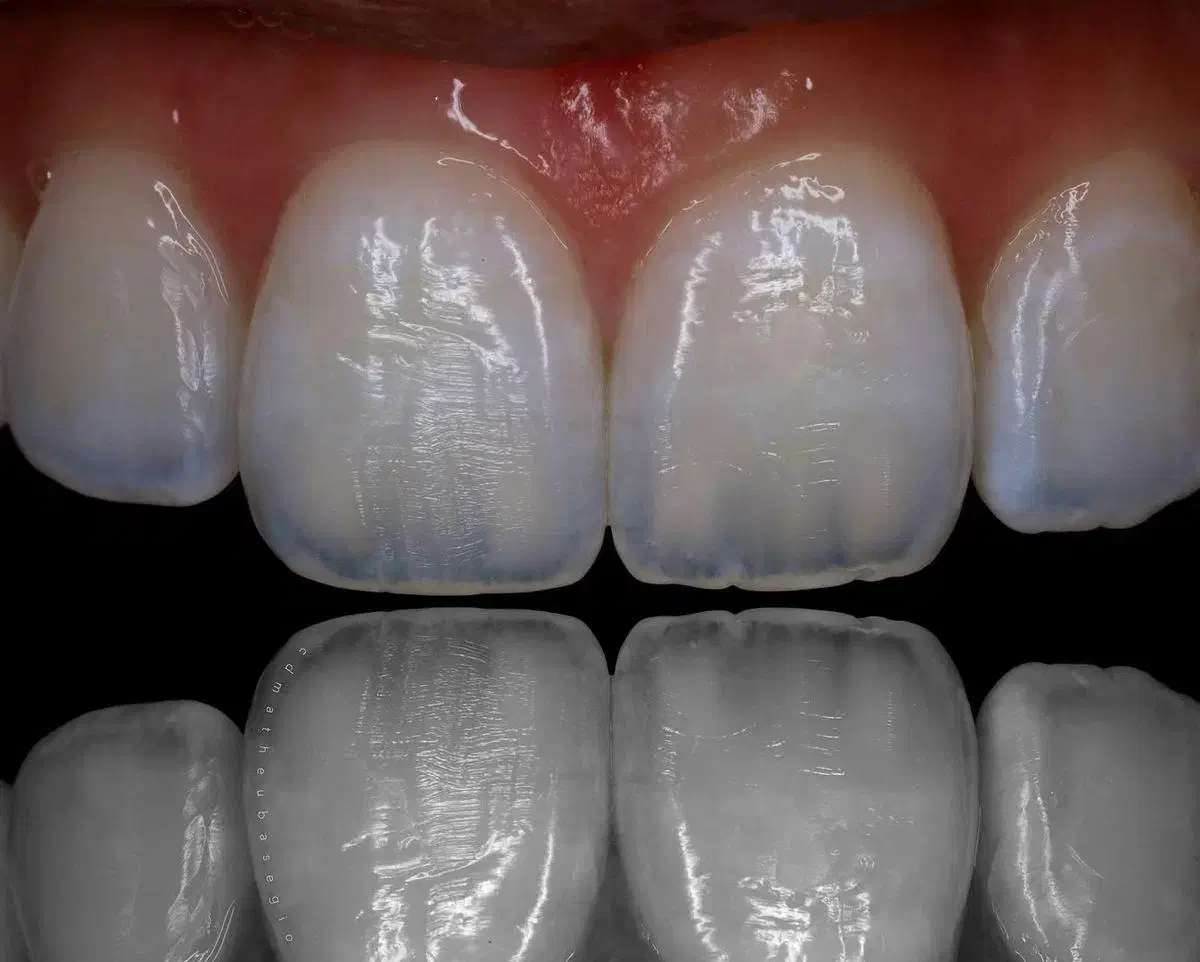 قسطی لب شیشه لیرینگ لمینیت جدید متفاوت دندان زیبا|خدمات آرایشگری و زیبایی|مشهد, سجاد شهر|دیوار