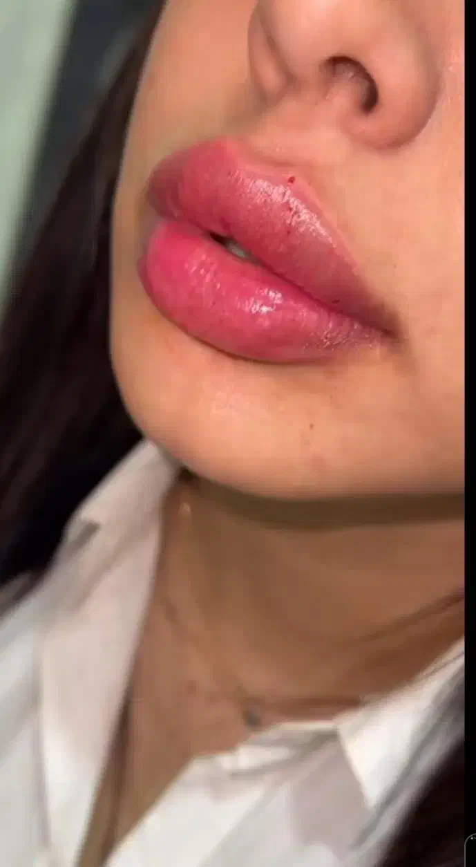 آموزش ژل و بوتاکس|خدمات آموزشی|زاهدان, |دیوار