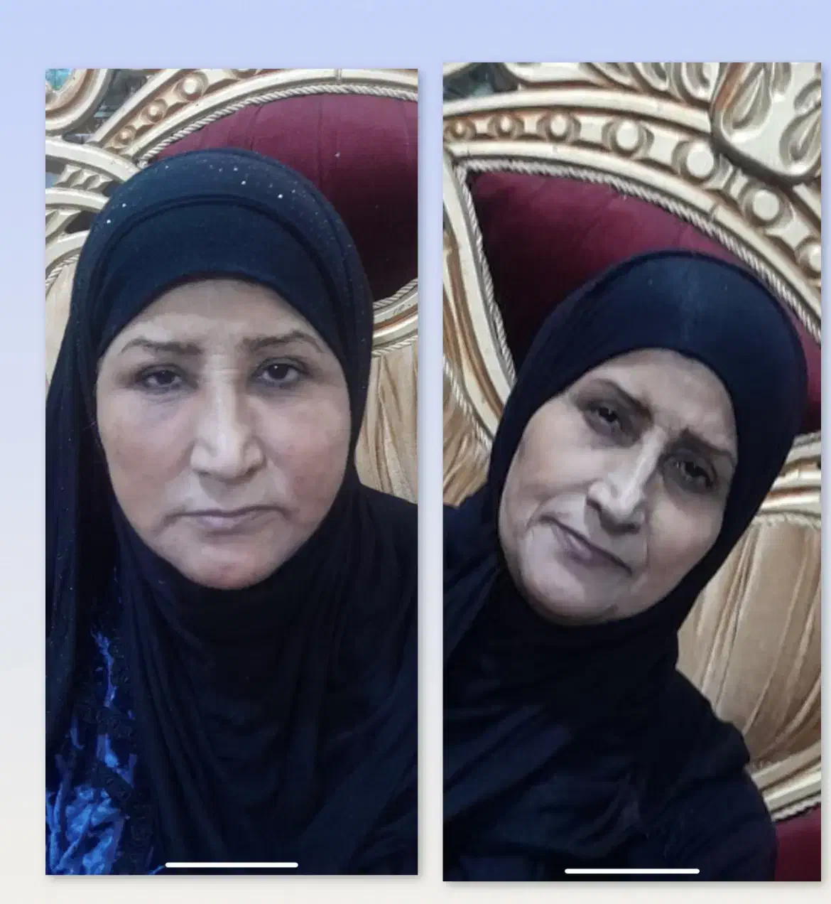 جشنواره خدمات پزشکی و جراحی و زیبایی در محدوده حرم|خدمات آرایشگری و زیبایی|مشهد, بالا خیابان|دیوار