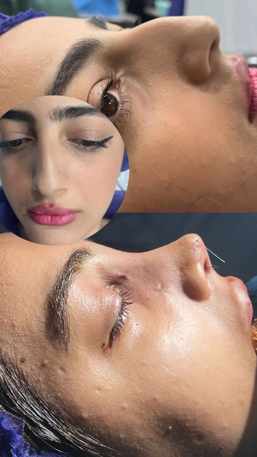 اف ویژه عمل بینی با ۴۰میلیون لیپو ۱۲۰در بیمارستان|خدمات زیبایی و سلامت|مشهد, احمدآباد|دیوار