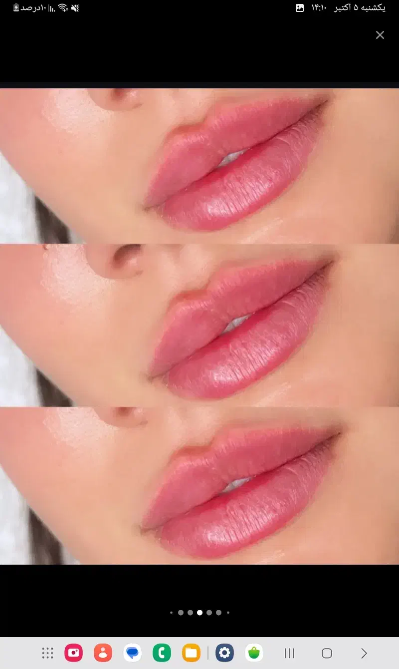 فیلر اقتصادی بوتاکس پیرسینگ|خدمات آرایشگری و زیبایی|ایرانشهر, |دیوار