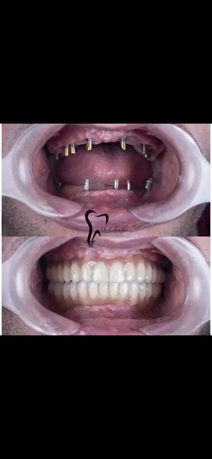 وام دندانپزشکی دکتر اسلامی فر|خدمات آرایشگری و زیبایی|ساوه, |دیوار