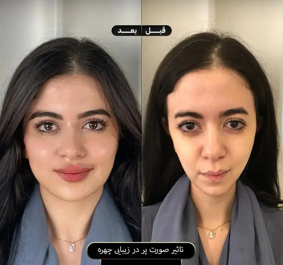 کرم سفید کننده صورت و بدن 10درجه سفیدی دائم|آرایشی، بهداشتی، درمانی|کرمان, |دیوار