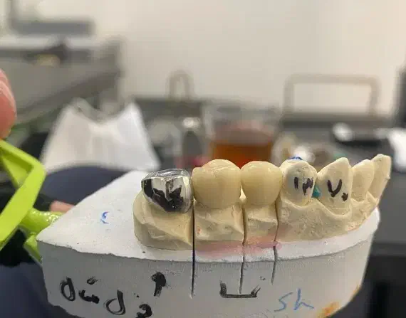 لابراتوار دندانسازی (روکش ثابت)|پزشکی|کرمانشاه, |دیوار