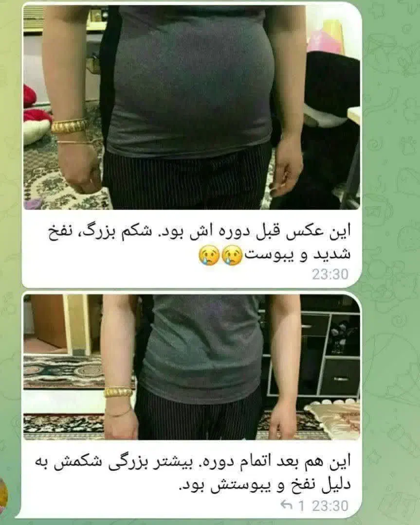 درمان چاقی با مشاوره رایگان|فعالیت داوطلبانه|ماهدشت, |دیوار