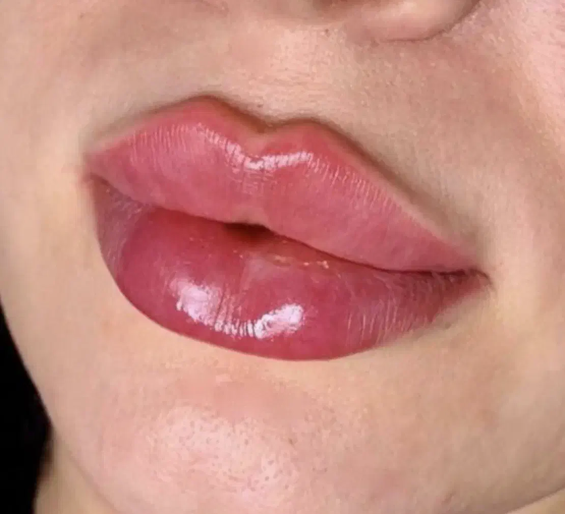 مدل فیلر و بوتاکس|خدمات آرایشگری و زیبایی|باقرشهر, |دیوار