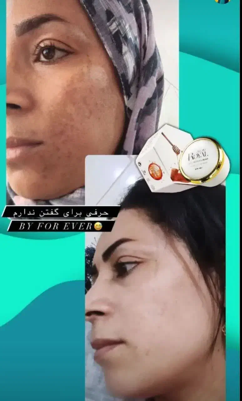 نمایندگی رویال دریاسوج ببرراضی نبودی پس میگیریم|آرایشی، بهداشتی، درمانی|دوگنبدان, |دیوار