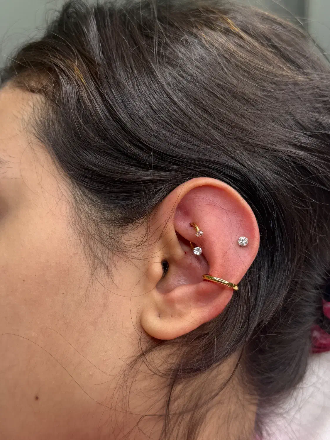 تخفیف ویژه بوتاکس ژل آنزیم پرسینگ|خدمات آرایشگری و زیبایی|گلستان (تهران), |دیوار