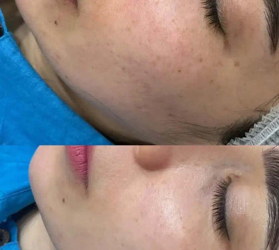 فیشال تخصصی فقط فردا ۳۰۰|خدمات آرایشگری و زیبایی|دورود, |دیوار