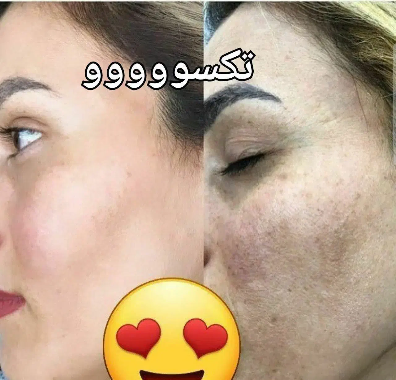 زیبایی پوست و مو|آرایشی، بهداشتی، درمانی|سنندج, |دیوار