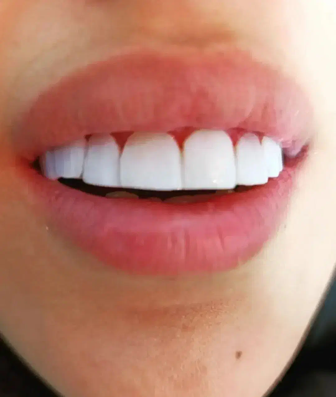 دندانپزشکی در خرم آباد با تخفیف ویژه|خدمات آرایشگری و زیبایی|دورود, |دیوار