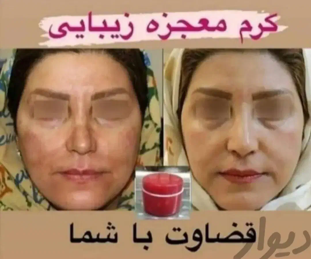 کرم سوپر معجزه صدرصد اصلی و ضمانتی|آرایشی، بهداشتی، درمانی|سنندج, |دیوار