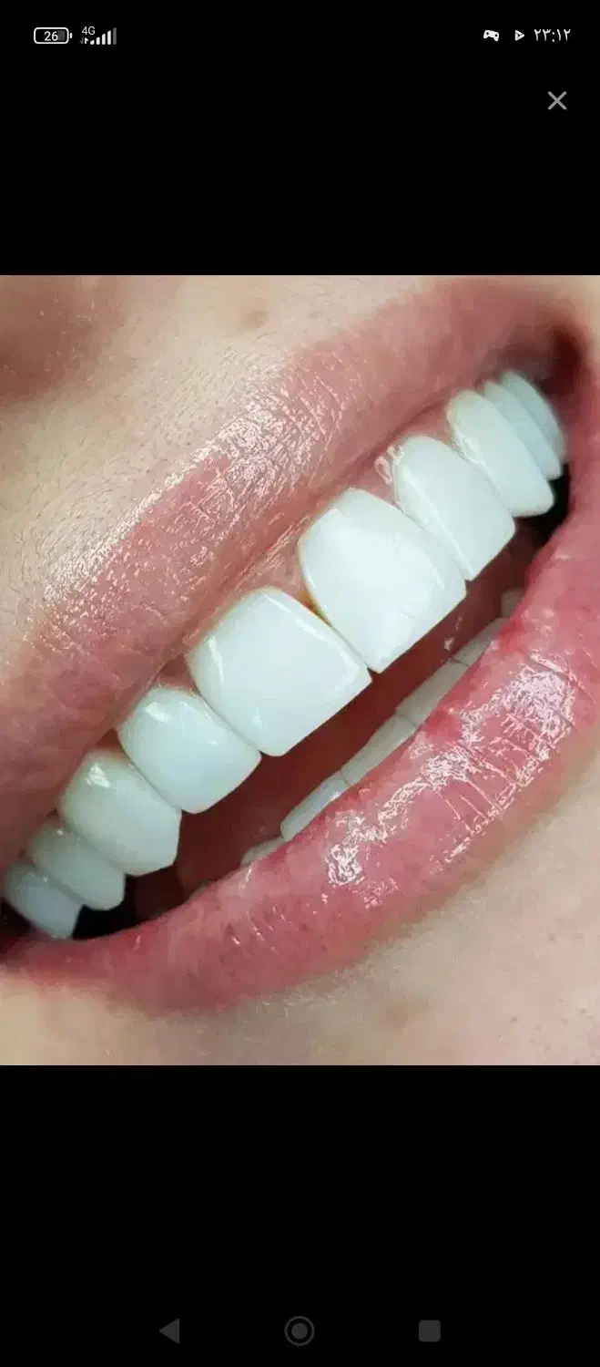 کوهدشت|خدمات آرایشگری و زیبایی|کوهدشت, |دیوار