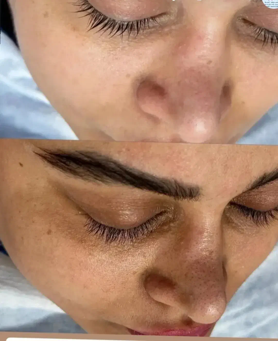 پاکسازی صورت|خدمات آرایشگری و زیبایی|هامون, |دیوار