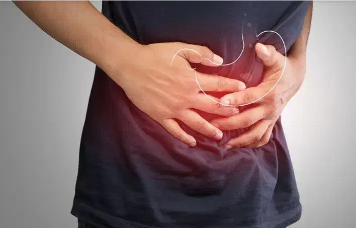 رفلاکش معده|پزشکی|سقز, |دیوار