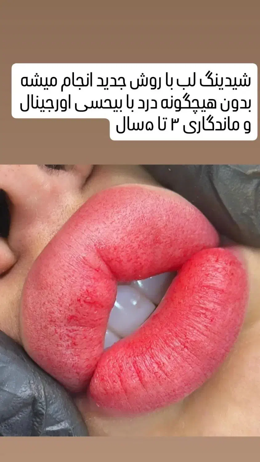 آموزش وخدمات تاتو صورت .میکرو . ریمور .مزوتراپی|خدمات آرایشگری و زیبایی|اهواز, کیانشهر|دیوار
