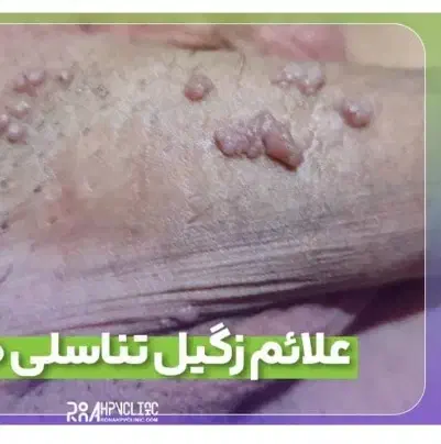 زگیل|آرایشی، بهداشتی، درمانی|یاسوج, |دیوار