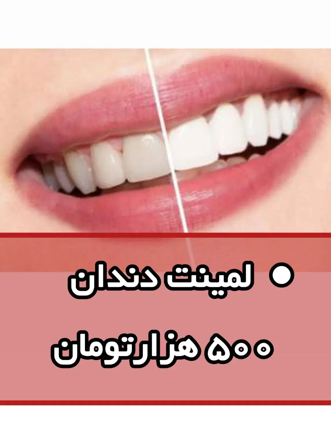 مانکور آلمانیPS|تخت و صندلی بچه|اصفهان, ملک|دیوار