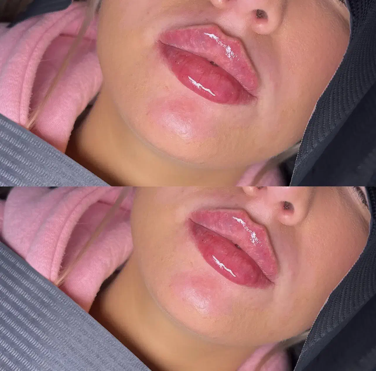 لیزر موهای زائد بدن،پاک کردن تاتو،پیلینگ هالیوددی|خدمات آرایشگری و زیبایی|قرچک, زیبا شهر|دیوار