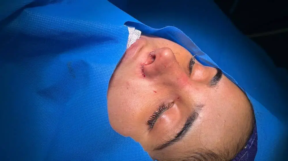 مژه|خدمات زیبایی و سلامت|دزفول, |دیوار