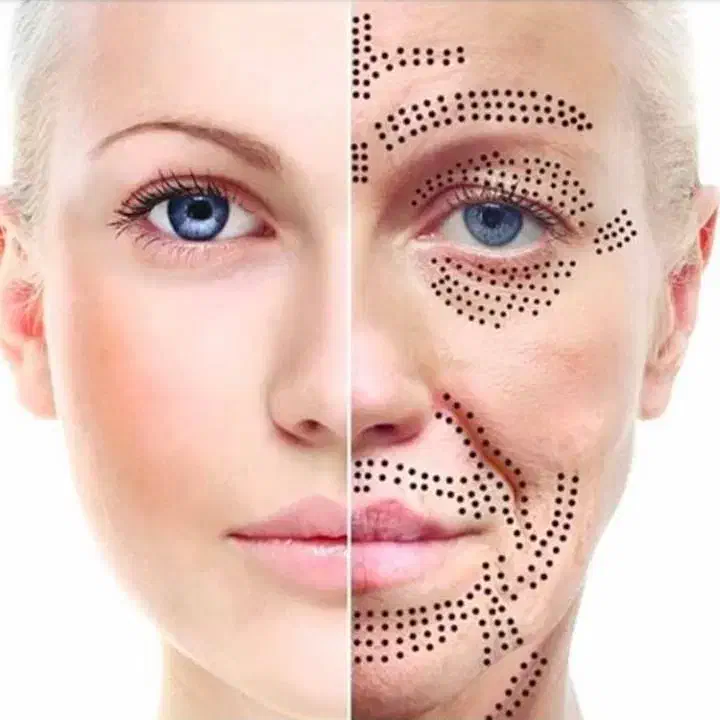 خدمات حرفه ای پلکسر(پلاسماجت)|خدمات آرایشگری و زیبایی|اسلام‌شهر, سیمرغ|دیوار