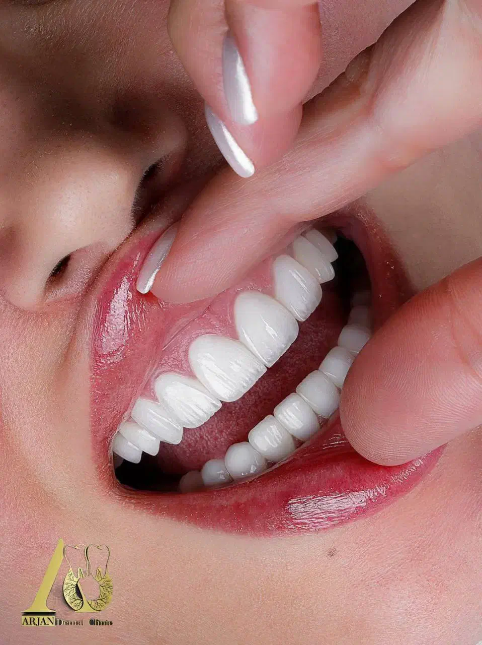 ایمپلنت اقساط بدون سود/جشنواره پاییزی به مدت محدود|خدمات آرایشگری و زیبایی|تهران, مجیدیه|دیوار