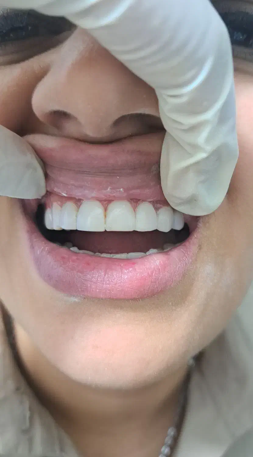 آموزش کامپوزیت دندان۱۰تومن|خدمات آموزشی|اهواز, رسالت|دیوار