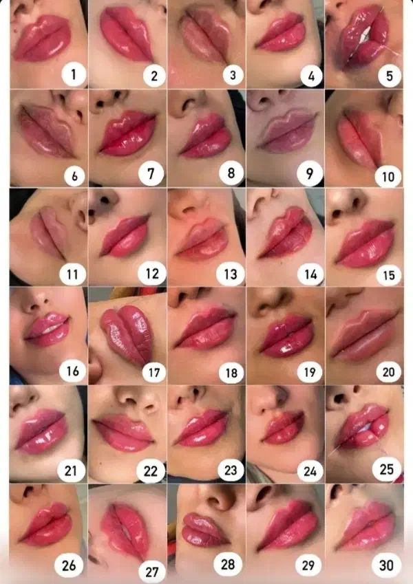 شگفتانه قیمت فیلر و بوتاکس فقط تا پایان هفته|خدمات آرایشگری و زیبایی|رشت, گلسار|دیوار