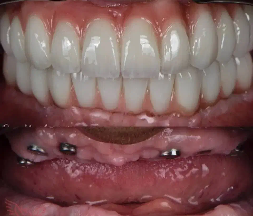 دندانپزشکی مرکز تخصصی ایمپلنت در تبریز|خدمات آرایشگری و زیبایی|مرند, |دیوار