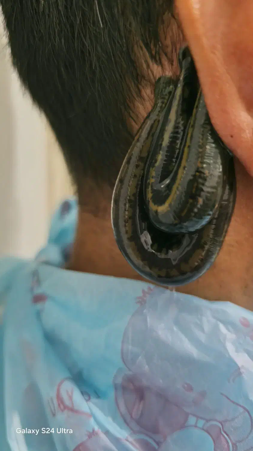 حجامت،فصد،زالو|خدمات آرایشگری و زیبایی|یاسوج, |دیوار