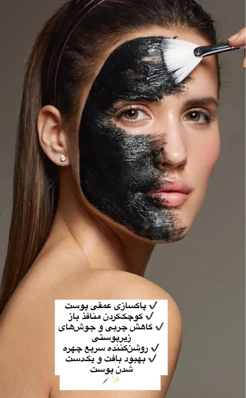 کربن تراپی|خدمات آرایشگری و زیبایی|یاسوج, |دیوار