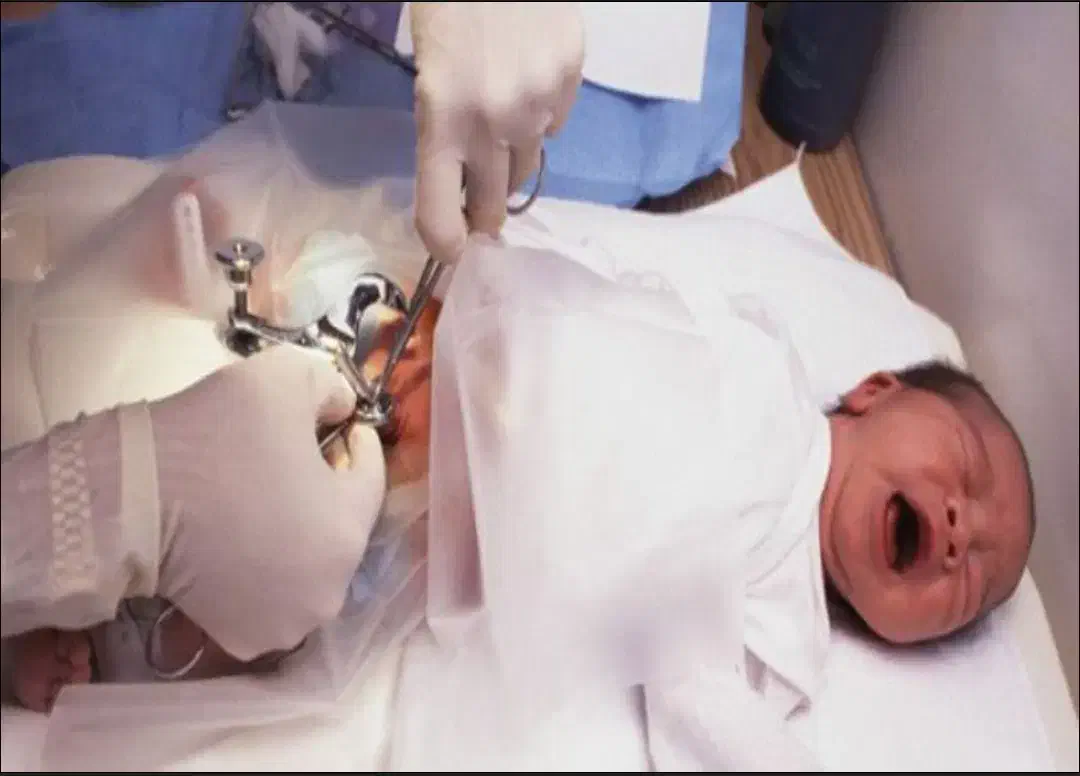 ختنه خاصه(پسر)|آرایشی، بهداشتی، درمانی|بیرجند, |دیوار