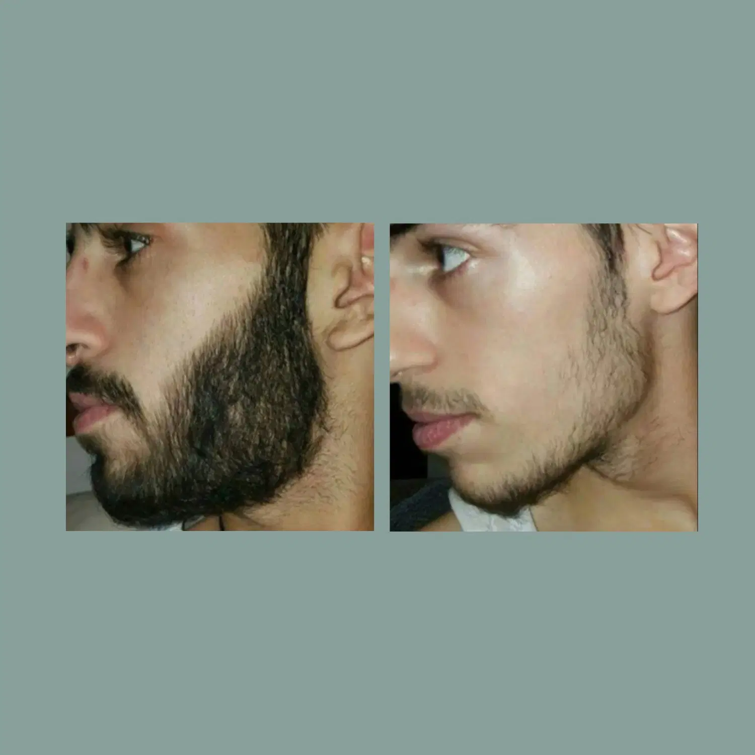 ۳۰بیله|آرایشی، بهداشتی، درمانی|نورآباد ممسنی, |دیوار