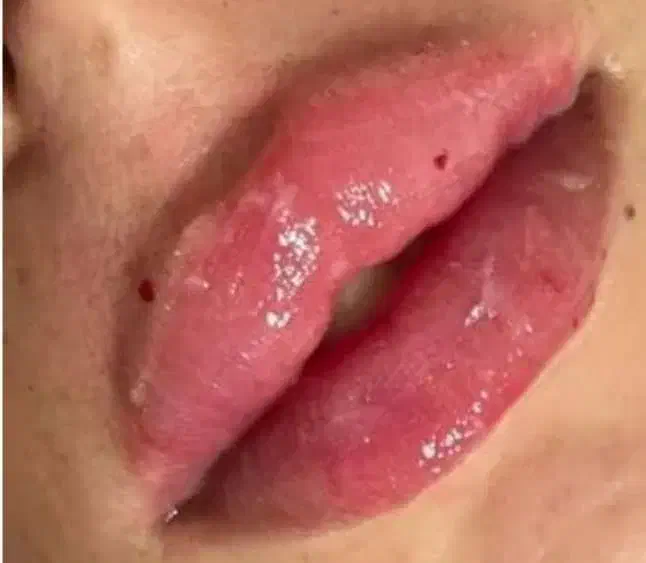 تزریق و آموزش خدمات ژل و بوتاکس و کراتین مو|خدمات آرایشگری و زیبایی|هشتگرد, شهرک اداری|دیوار