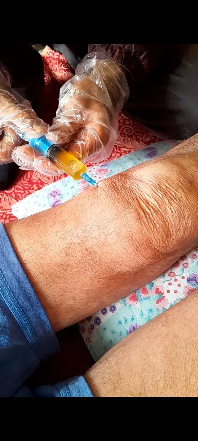 درمان آرتروز زانو/به روش پلاسما|خدمات آرایشگری و زیبایی|خرم‌آباد, |دیوار