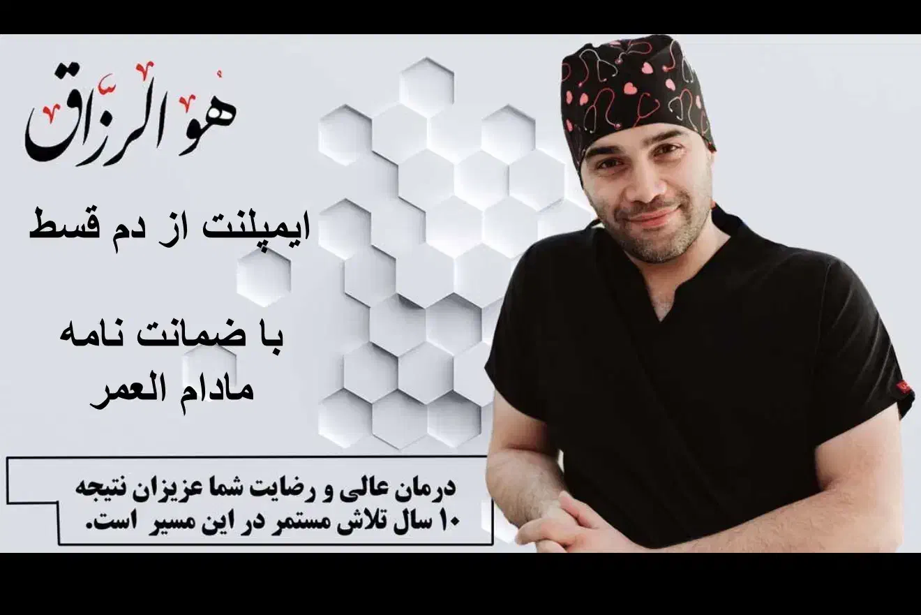 ایمپلنت اقساط با ضمانتنامه مادام العمر|خدمات آرایشگری و زیبایی|تهران, قیطریه|دیوار