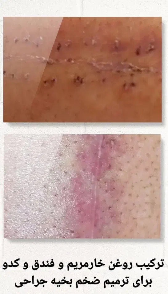 محصولات شرکت نیوشانیک|آرایشی، بهداشتی، درمانی|تهران, شهرک امام خمینی|دیوار