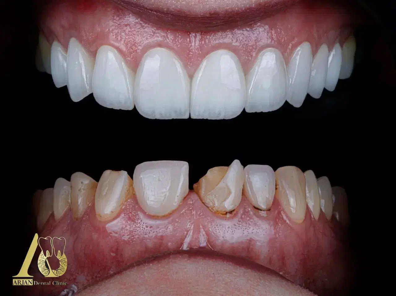 شرایط استثنایی ویژه عصب کشی،ترمیم،بلیچینگ،جرمگیری|خدمات آرایشگری و زیبایی|تهران, مجیدیه|دیوار