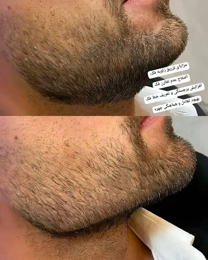 تخفیف ویژه|خدمات آرایشگری و زیبایی|تهران, سلسبیل شمالی|دیوار