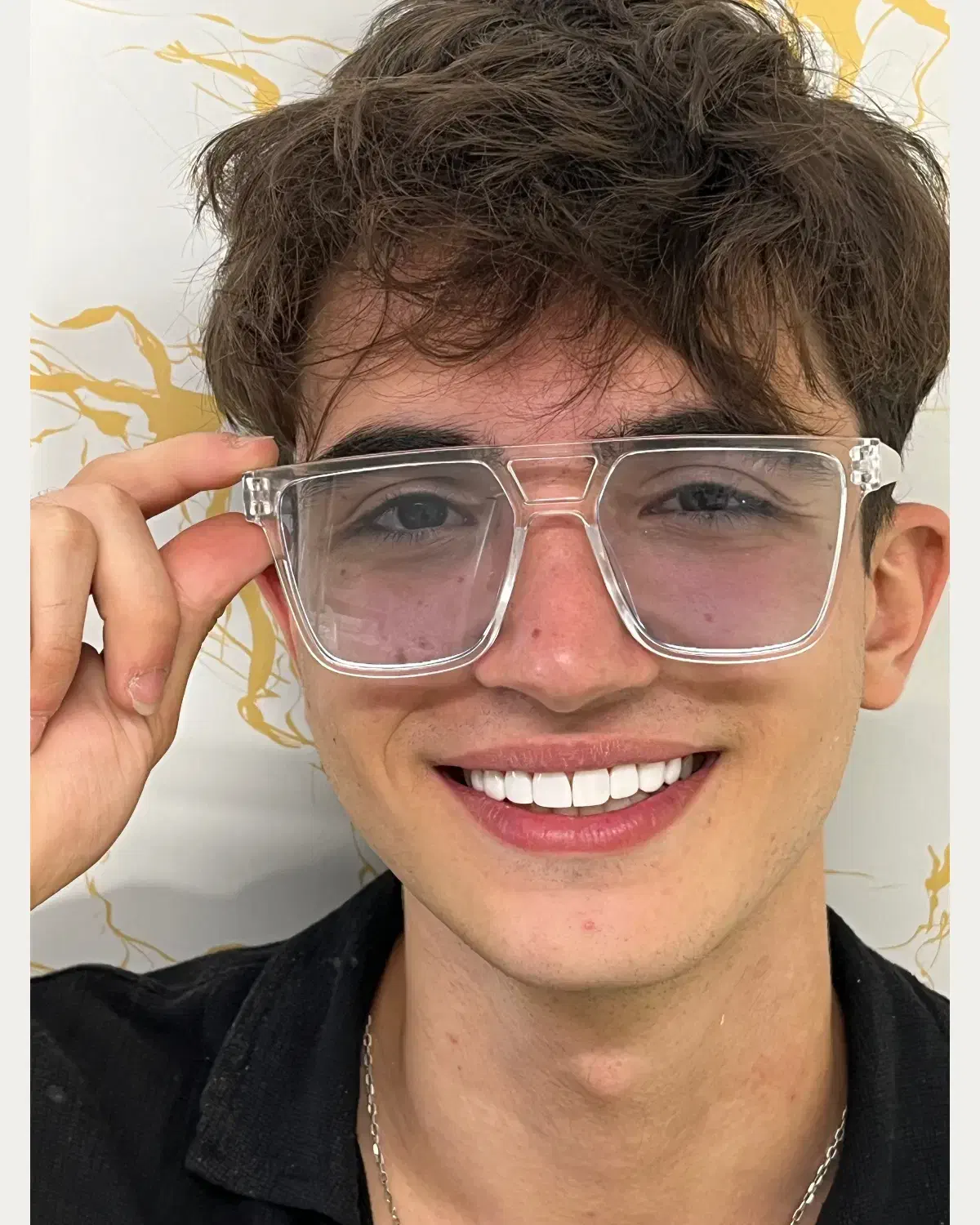 کامپوزیت دندان|خدمات آرایشگری و زیبایی|تهران, سلسبیل شمالی|دیوار