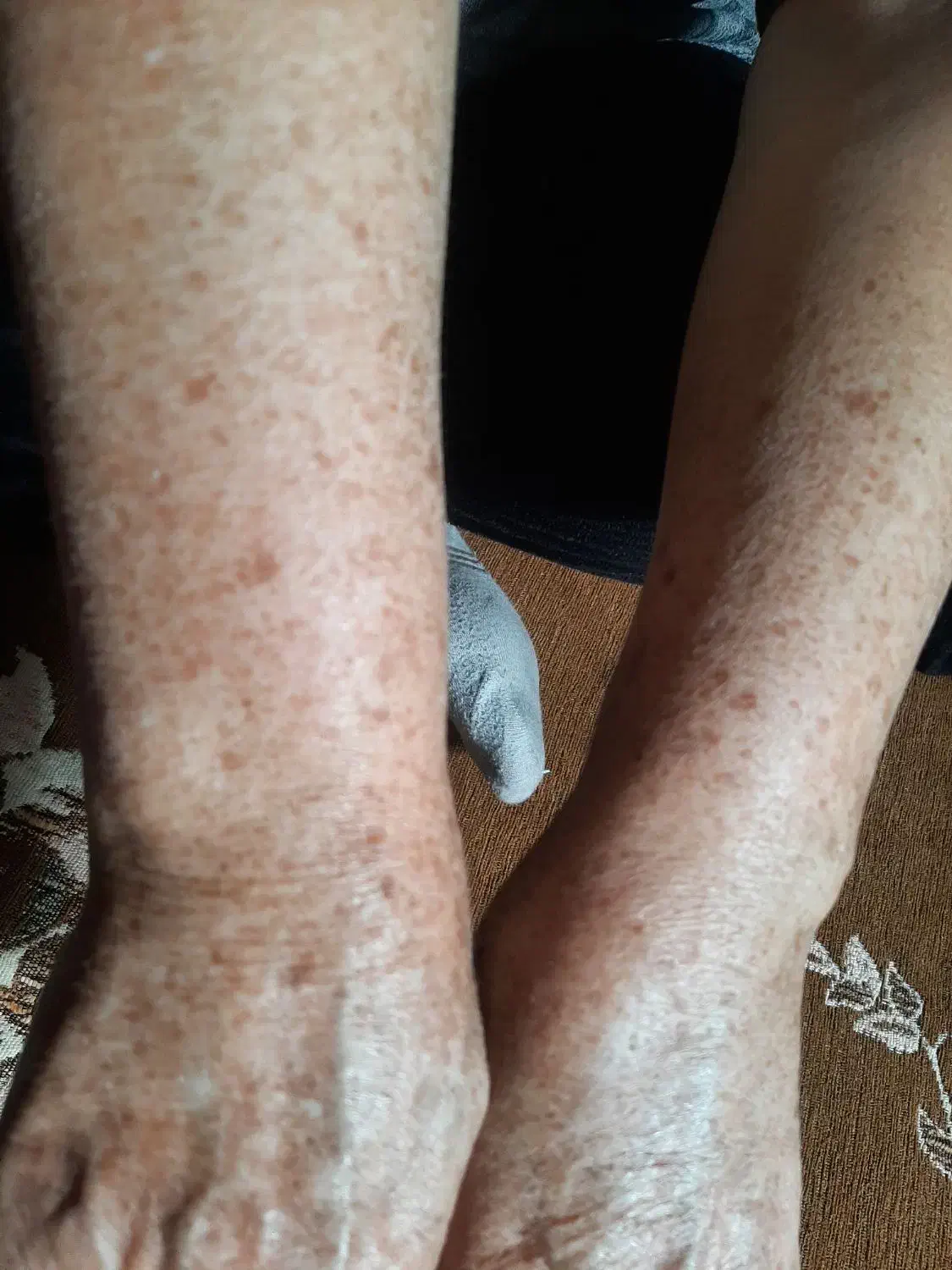 خال برداری|خدمات آرایشگری و زیبایی|دورود, |دیوار