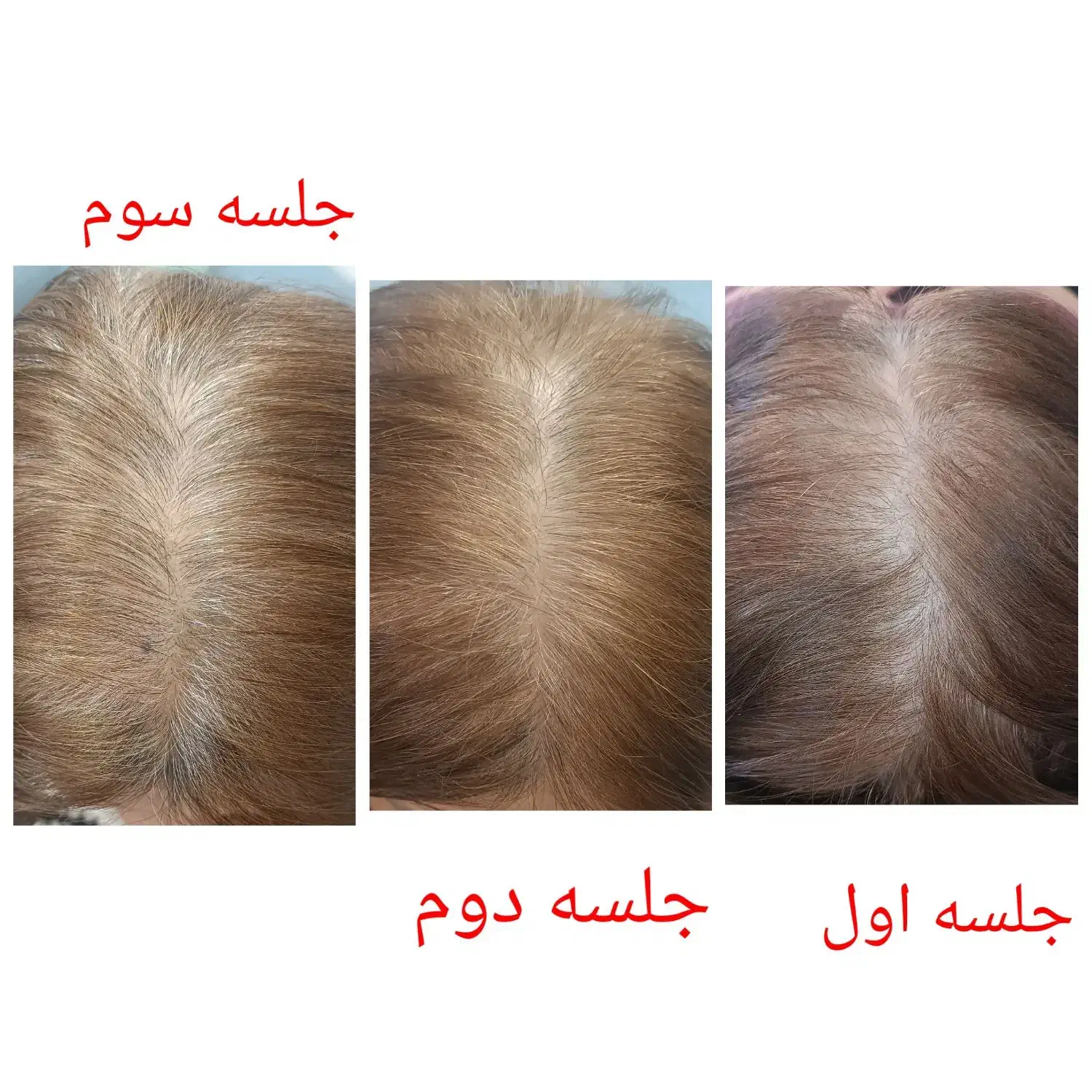 درمان ریزش مو،پوسته،شوره،خارش و بیماری های قارچی|خدمات آرایشگری و زیبایی|شیراز, شهرک امیر کبیر|دیوار