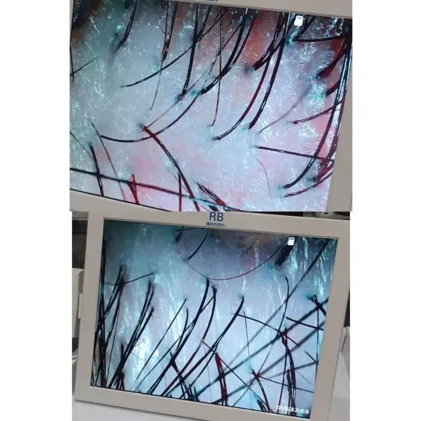 درمان ریزش مو،پوسته،شوره،خارش و بیماری های قارچی|خدمات آرایشگری و زیبایی|شیراز, شهرک امیر کبیر|دیوار