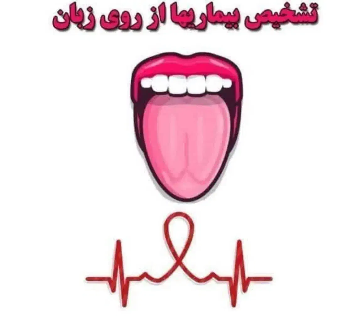 راز زبان|خدمات آموزشی|کرج, دانشگاه آزاد|دیوار