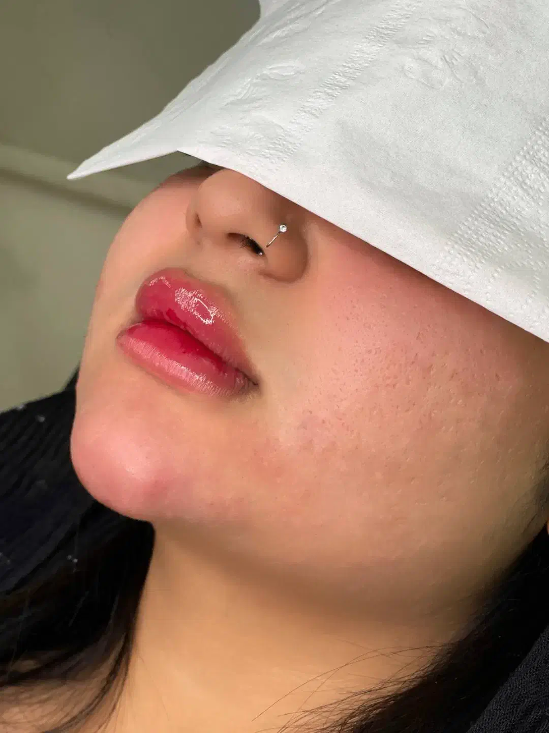 مدل رایگان ژل و بوتاکس|خدمات آرایشگری و زیبایی|تهران, دهقان|دیوار