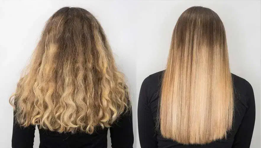 گلوبال و درمان ریزش مو|خدمات آرایشگری و زیبایی|نیشابور, دارایی|دیوار