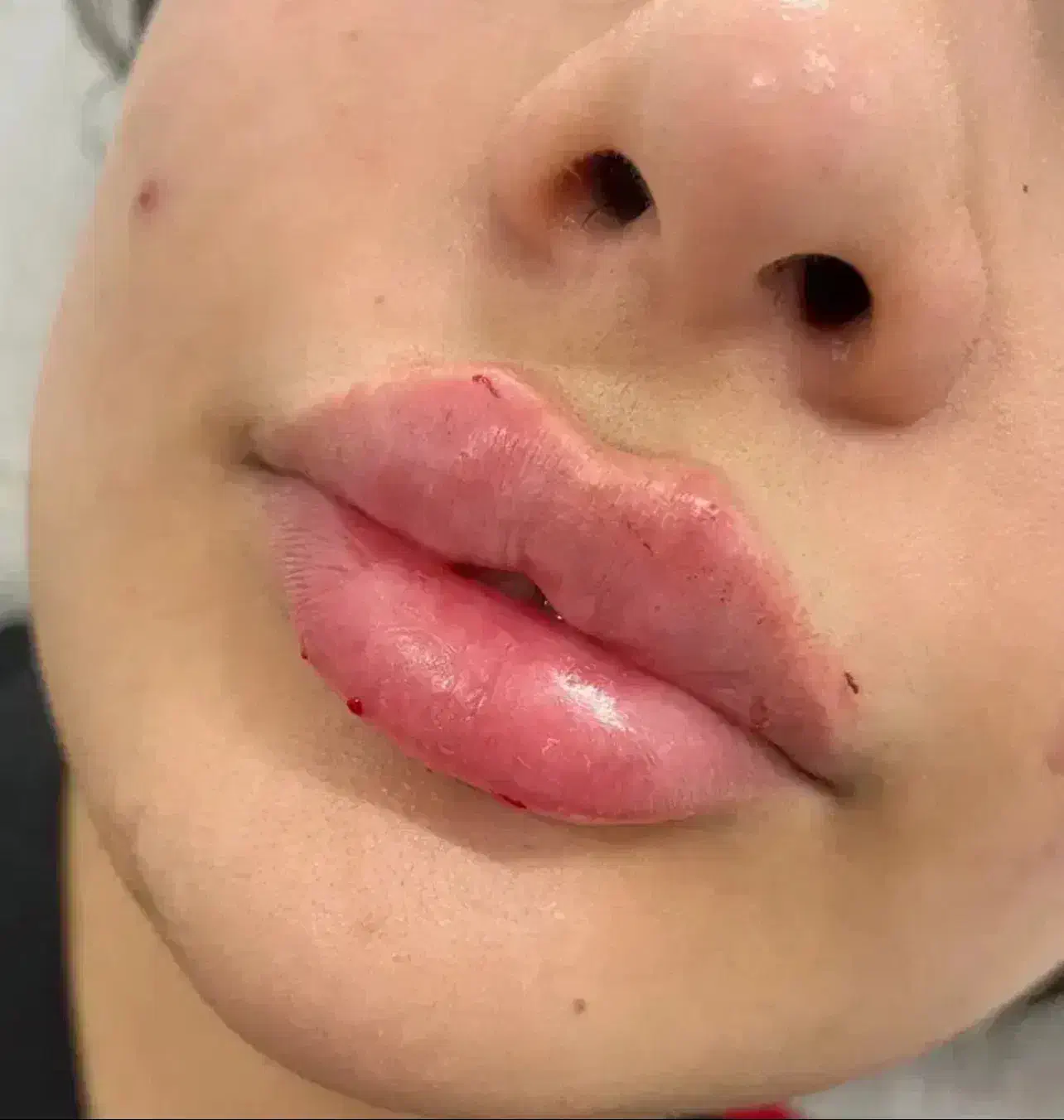 تزریق انواع فیلر (ژل )بوتاکس وخدمات میکروپیگمنتیشن|خدمات آرایشگری و زیبایی|یاسوج, |دیوار